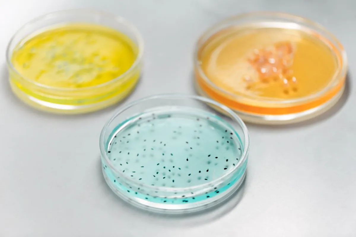 Petri dishes used in Salmonella testing of sesame and spices